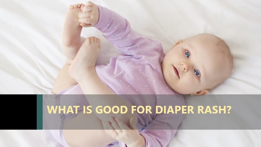 what-is-good-for-diaper-rash-anket-r