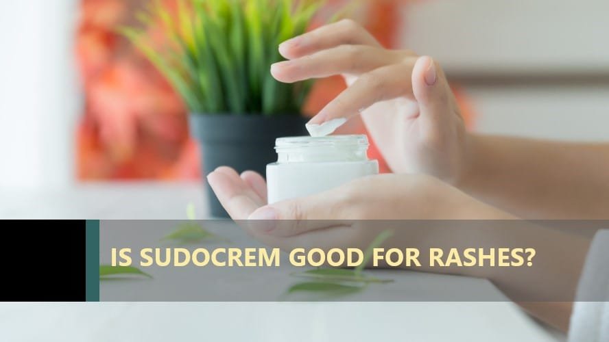 is-sudocrem-good-for-rashes-anket-r